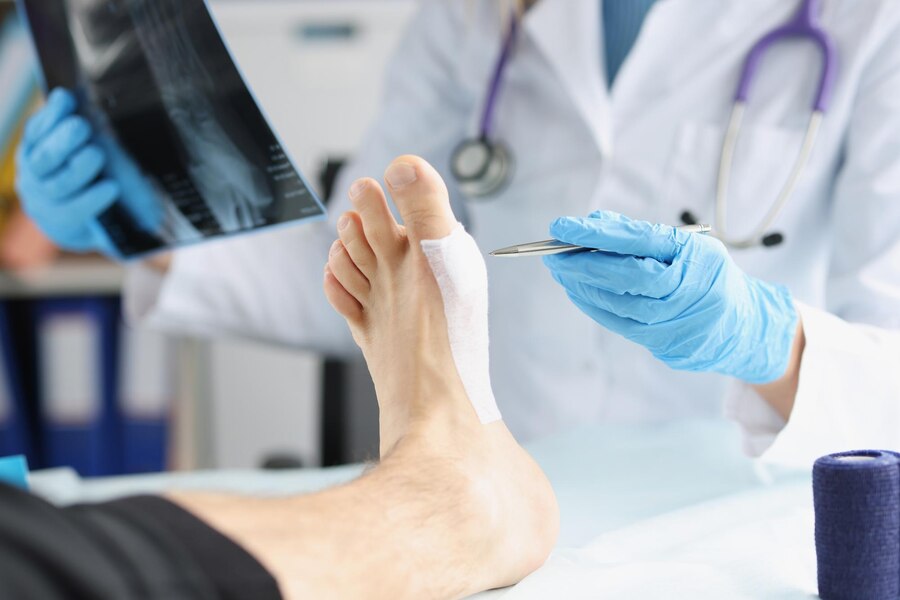 Treatment of diabetic foot and prevention of amputation