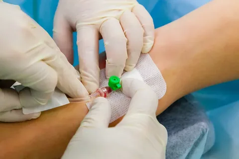 Treatment of arterial blockage with peripheral catheterization