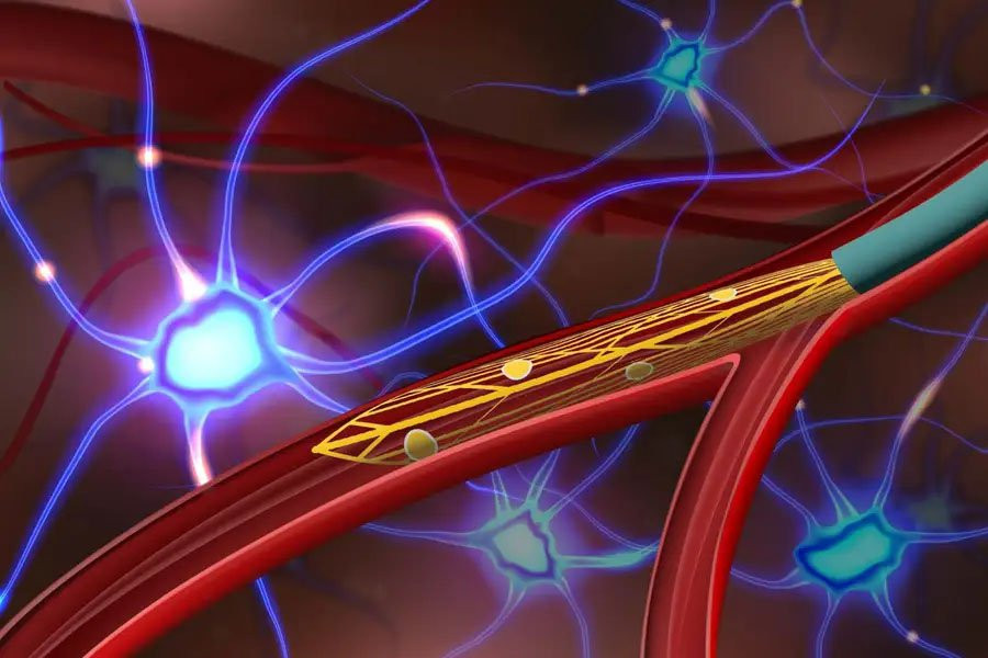 Doppler and duplex scans of blood vessels